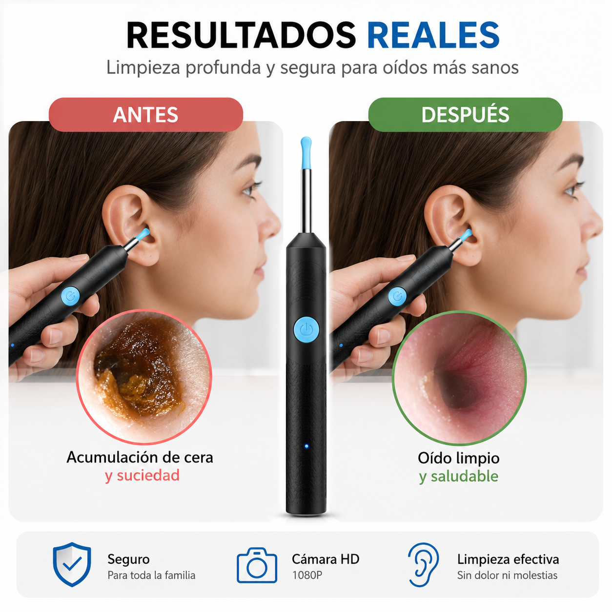 Otoscopio Inteligente HD