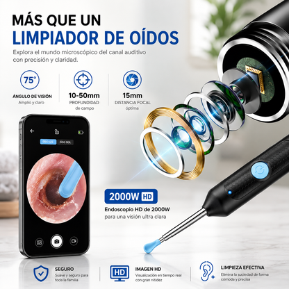Otoscopio Inteligente HD